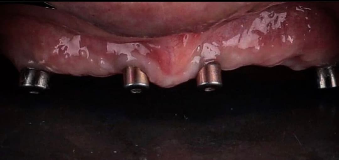الزراعة before 